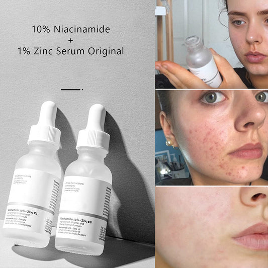 The Ordinary Niacinamide 10% + Zinc 1% Serum 100% Original + Barcode Scan